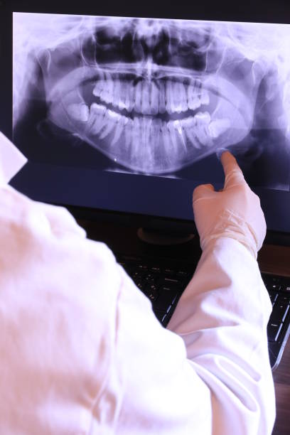 Best Broken or Chipped Tooth Repair in Bridgeport, NY