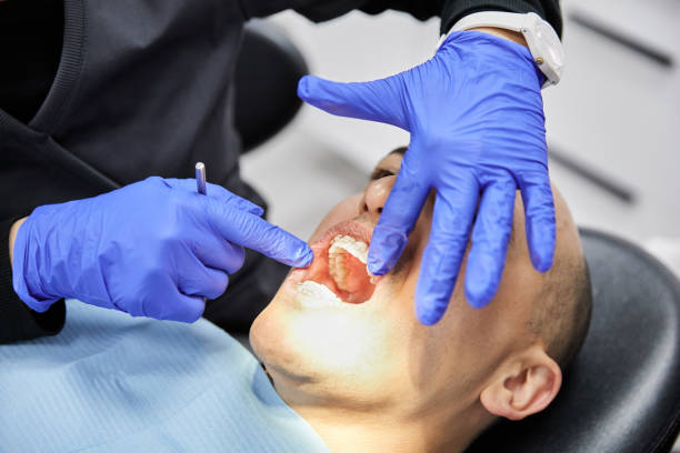 Best Emergency Denture Repair in Bridgeport, NY